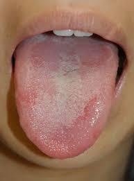 する 舌 が ピリピリ