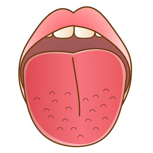栄養不足によって起きる舌のトラブル オーソモレキュラー 口腔アンド栄養 療法 あんどう口腔クリニック